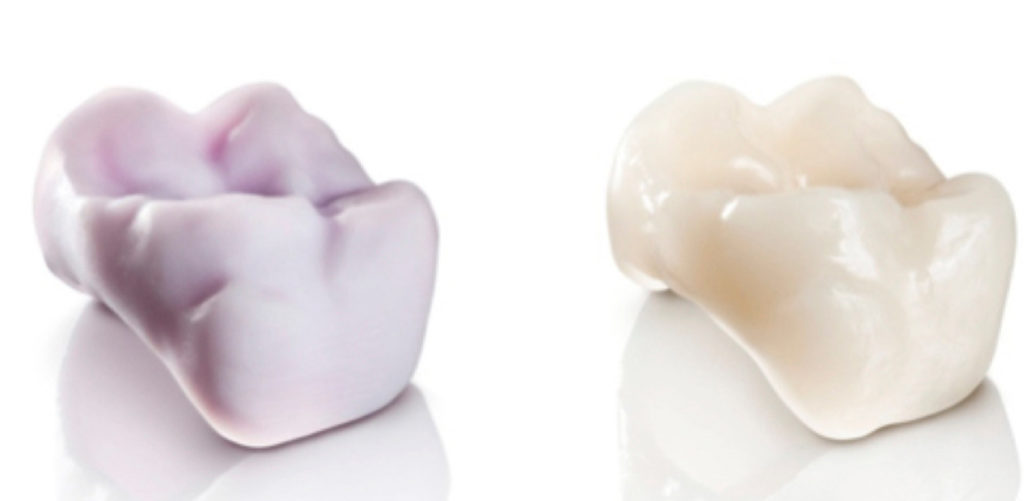 CAD/CAM Provisionals | Digital Dental Arts Laboratory